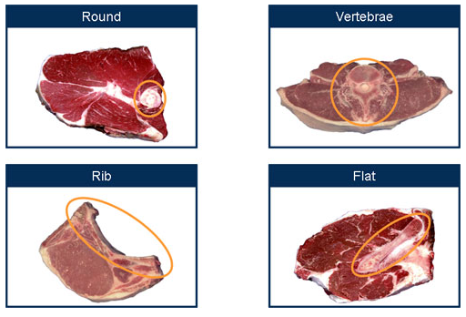 Types of Bones